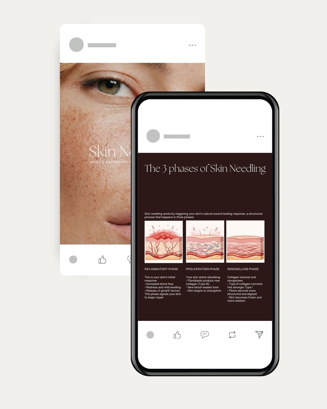 Canva carousel template for skin clinics – before and after layout